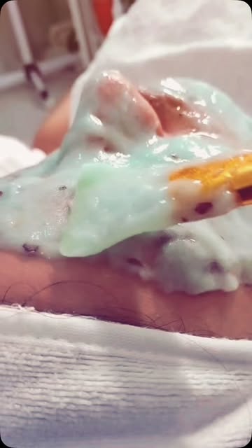 Tratamiento facial profesional